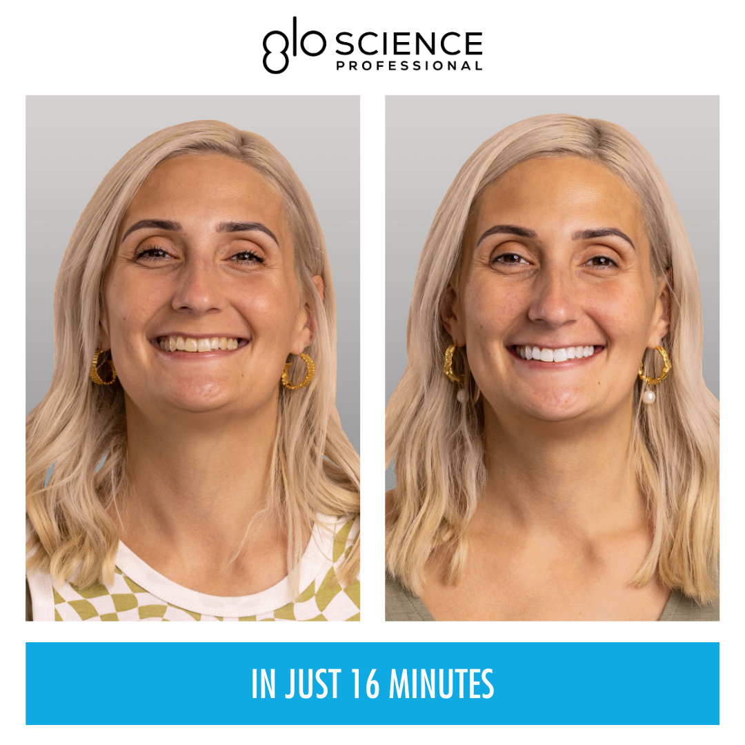 Glo Science campaign creative