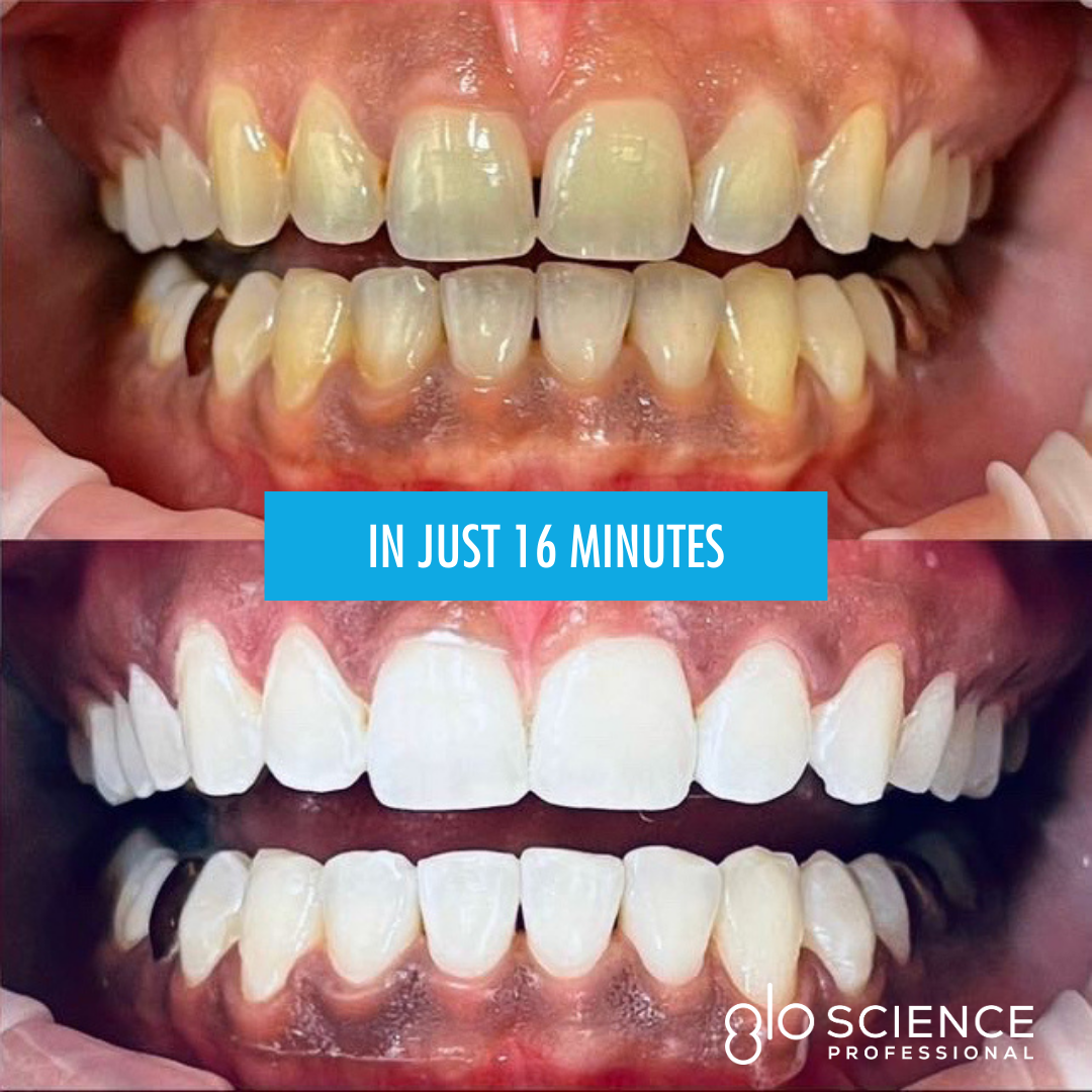 Glo Science campaign creative